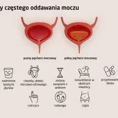 Ilustracja pokazuje przyczyny częstego oddawania moczu w nocy: nadmierne picie, choroby, wiek, naświetlanie, leki, cukrzyca, nadwaga, ciąża.