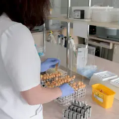 Laborantka bada próbki moczu, szukając przyczyn, dla których ciężar właściwy moczu za niski.