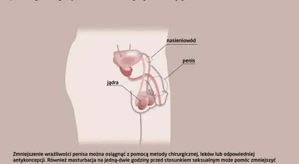 Ilustracja układu rozrodczego męskiego z zaznaczonym penisem, jądrami i nasieniowodem. Tekst informuje o metodach leczenia przedwczesnego wytrysku, w tym o zmniejszeniu wrażliwości penisa.