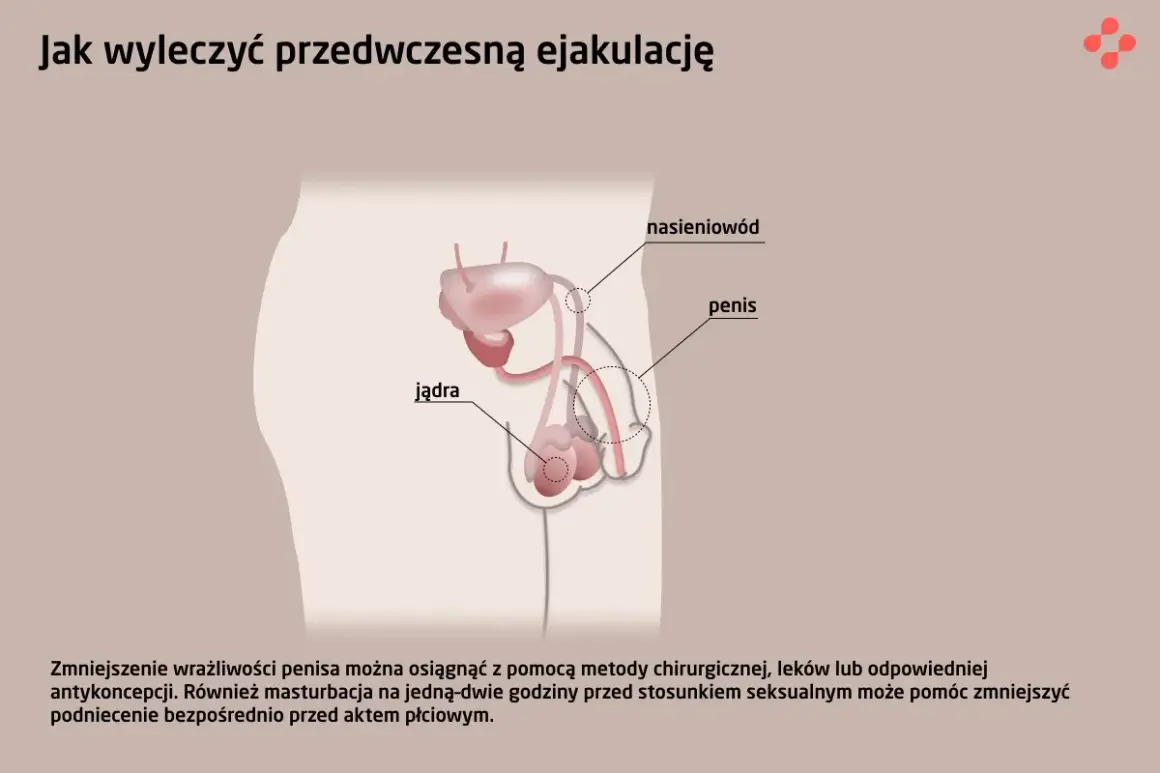 Ilustracja układu rozrodczego męskiego z zaznaczonym penisem, jądrami i nasieniowodem. Tekst informuje o metodach leczenia przedwczesnego wytrysku, w tym o zmniejszeniu wrażliwości penisa.