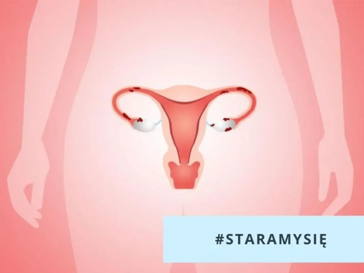 Ilustracja narządów rodnych kobiety. Tyłozgięcie macicy a poród - czy to przeszkoda w zajściu w ciążę? #STARAMYSIĘ