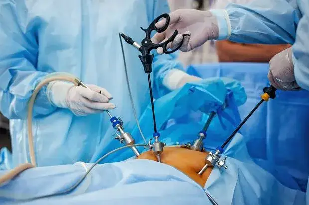 laparoskopia urologiczna