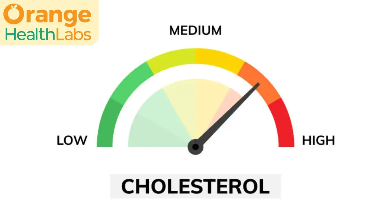 Wskaźnik poziomu cholesterolu, od niskiego do wysokiego. Czy stres podnosi cholesterol? Ten wykres pokazuje, że może.