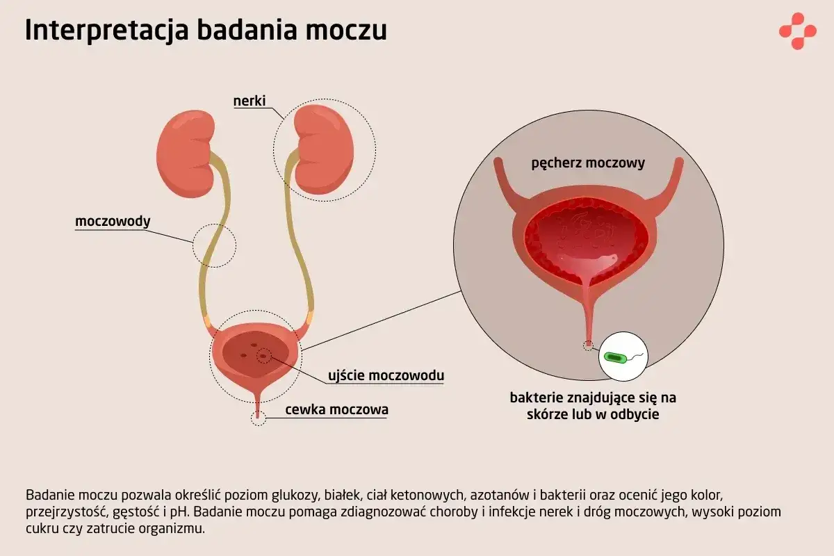 Ilustracja układu moczowego z nerkami, moczowodami i pęcherzem. Widoczne bakterie pałeczki, mogące wskazywać na infekcję.