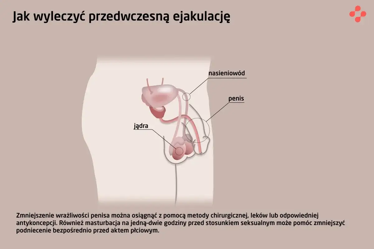 Ilustracja układu rozrodczego męskiego, omawiająca problem z wytryskiem. Pokazuje jądra, nasieniowód i penis.