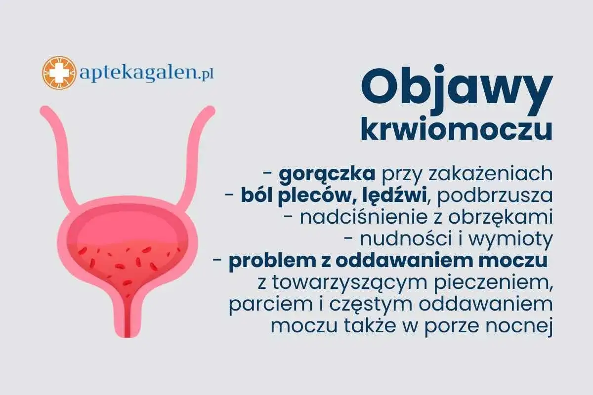 Objawy krwiomoczu: gorączka, ból pleców, nadciśnienie, nudności, wymioty, problem z oddawaniem moczu. Może to być objaw guza pęcherza moczowego.